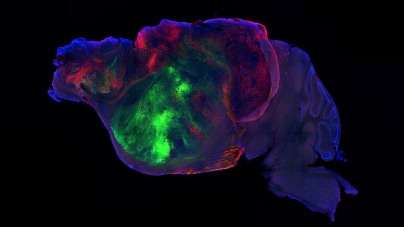 Researchers have created a mouse with a partly human brain