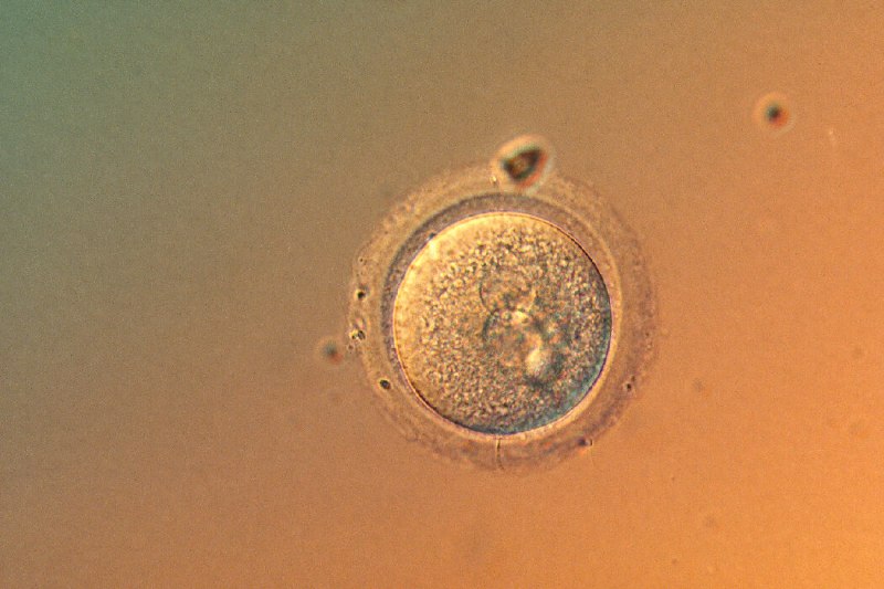 科学家首次精确编辑人类胚胎基因
